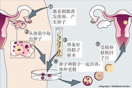 胚胎实验室